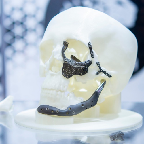 Titanium for medical implants